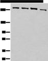 PRPF8 Antibody - Western blot analysis of 293T cell lysates  using PRPF8 Polyclonal Antibody at dilution of 1:450