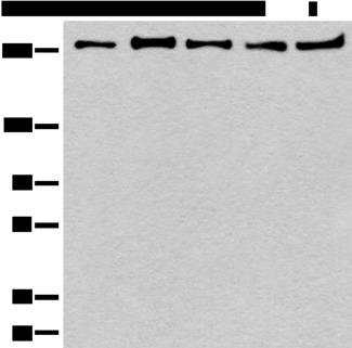 PRPF8 Antibody - Western blot analysis of 293T K562 Raji Hela and NIH/3T3 cell lysates  using PRPF8 Polyclonal Antibody at dilution of 1:600