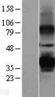 PRPH2 Protein - Western validation with an anti-DDK antibody * L: Control HEK293 lysate R: Over-expression lysate