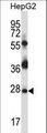 PRPK / TP53RK Antibody - Mouse Tp53rk Antibody western blot of HepG2 cell line lysates (35 ug/lane). The Tp53rk antibody detected the Tp53rk protein (arrow).