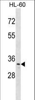 PRPK / TP53RK Antibody - TP53RK Antibody western blot of HL-60 cell line lysates (35 ug/lane). The TP53RK antibody detected the TP53RK protein (arrow).