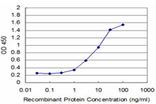 PRPK / TP53RK Antibody - Detection limit for recombinant GST tagged TP53RK is approximately 1 ng/ml as a capture antibody.