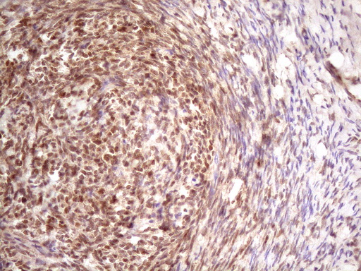 PRPK / TP53RK Antibody - IHC of paraffin-embedded Human Ovary tissue using anti-TP53RK mouse monoclonal antibody. (Heat-induced epitope retrieval by 1 mM EDTA in 10mM Tris, pH8.5, 120°C for 3min)(1:150).