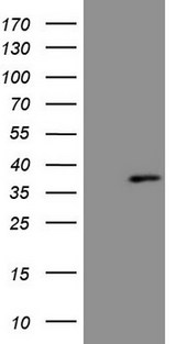 PRPK / TP53RK Antibody - HEK293T cells were transfected with the pCMV6-ENTRY control. (Left lane) or pCMV6-ENTRY. (Right lane) cDNA for 48 hrs and lysed