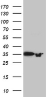 PRPS1L1 Antibody - HEK293T cells were transfected with the pCMV6-ENTRY control. (Left lane) or pCMV6-ENTRY PRPS1L1. (Right lane) cDNA for 48 hrs and lysed. Equivalent amounts of cell lysates. (5 ug per lane) were separated by SDS-PAGE and immunoblotted with anti-PRPS1L1. (1:2000)