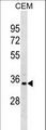 PRPS1L1 Antibody - PRPS1L1 Antibody western blot of CEM cell line lysates (35 ug/lane). The PRPS1L1 antibody detected the PRPS1L1 protein (arrow).