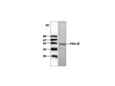 PRPS1L1 Antibody