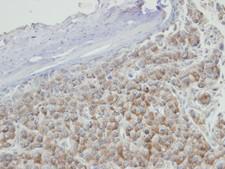 PRPS2 Antibody - IHC of paraffin-embedded Hep3B xenograft using PRPS2 antibody at 1:100 dilution.