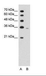 PRPS2 Antibody - A: Marker, B: Jurkat Cell Lysate.  This image was taken for the unconjugated form of this product. Other forms have not been tested.