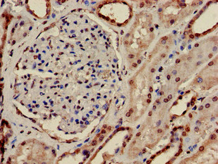 PRPS2 Antibody - Immunohistochemistry of paraffin-embedded human kidney tissue at dilution of 1:100