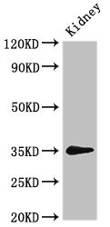 PRPS2 Antibody - Western Blot Positive WB detected in:Rat kidney tissue All Lanes:PRPS2 antibody at 3µg/ml Secondary Goat polyclonal to rabbit IgG at 1/50000 dilution Predicted band size: 35,36 KDa Observed band size: 35 KDa