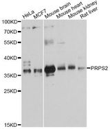 PRPS2 Antibody - Western blot analysis of extracts of various cell lines, using PRPS2 antibody at 1:3000 dilution. The secondary antibody used was an HRP Goat Anti-Rabbit IgG (H+L) at 1:10000 dilution. Lysates were loaded 25ug per lane and 3% nonfat dry milk in TBST was used for blocking. An ECL Kit was used for detection and the exposure time was 30s.