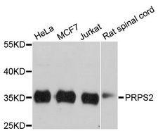 PRPS2 Antibody - Western blot analysis of extracts of various cell lines, using PRPS2 antibody at 1:3000 dilution. The secondary antibody used was an HRP Goat Anti-Rabbit IgG (H+L) at 1:10000 dilution. Lysates were loaded 25ug per lane and 3% nonfat dry milk in TBST was used for blocking. An ECL Kit was used for detection and the exposure time was 30s.