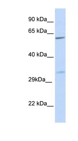 PRPS2 Antibody - PRPS2 antibody Western blot of 721_B cell lysate. This image was taken for the unconjugated form of this product. Other forms have not been tested.
