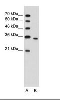 PRPS2 Antibody - A: Marker, B: Jurkat Cell Lysate.  This image was taken for the unconjugated form of this product. Other forms have not been tested.
