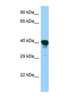 PRPSAP1 Antibody - PRPSAP1 antibody Western blot of Mouse Kidney lysate. Antibody concentration 1 ug/ml.  This image was taken for the unconjugated form of this product. Other forms have not been tested.