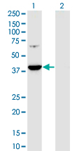 PRPSAP1 Antibody - Western Blot analysis of PRPSAP1 expression in transfected 293T cell line by PRPSAP1 monoclonal antibody (M01), clone 5H10.Lane 1: PRPSAP1 transfected lysate (Predicted MW: 39.4 KDa).Lane 2: Non-transfected lysate.