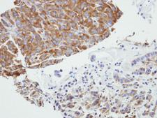 PRPSAP2 Antibody - IHC of paraffin-embedded A549 xenograft using PRPSAP2 antibody at 1:500 dilution.