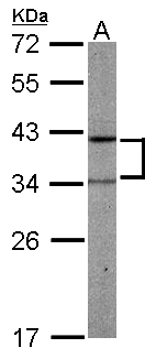 PRPSAP2 Antibody - Sample (50 ug of whole cell lysate). A: mouse liver. 12% SDS PAGE. PRPSAP2 antibody diluted at 1:1000.
