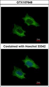 PRPSAP2 Antibody - Immunofluorescence of methanol-fixed HeLa using PRPSAP2 antibody at 1:500 dilution.