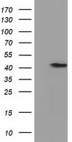 PRPSAP2 Antibody - HEK293T cells were transfected with the pCMV6-ENTRY control (Left lane) or pCMV6-ENTRY PRPSAP2 (Right lane) cDNA for 48 hrs and lysed. Equivalent amounts of cell lysates (5 ug per lane) were separated by SDS-PAGE and immunoblotted with anti-PRPSAP2.