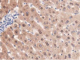 PRPSAP2 Antibody - Immunohistochemical staining of paraffin-embedded Human liver tissue using anti-PRPSAP2 mouse monoclonal antibody.