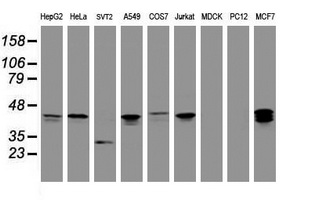 PRR11 Antibody - Western blot of extracts (35ug) from 9 different cell lines by using anti-PRR11 monoclonal antibody (HepG2: human; HeLa: human; SVT2: mouse; A549: human; COS7: monkey; Jurkat: human; MDCK: canine; PC12: rat; MCF7: human).
