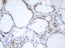 PRR11 Antibody - IHC of paraffin-embedded Human thyroid tissue using anti-PRR11 mouse monoclonal antibody. (Heat-induced epitope retrieval by 10mM citric buffer, pH6.0, 100C for 10min).