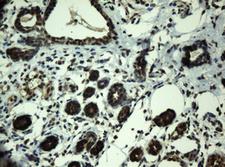 PRR11 Antibody - IHC of paraffin-embedded Human breast tissue using anti-PRR11 mouse monoclonal antibody.
