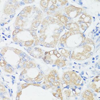 PRR11 Antibody - Immunohistochemistry of paraffin-embedded Human stomach using PRR11 Polyclonal Antibody at dilution of 1:100 (40x lens).