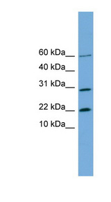 PRR13 Antibody - PRR13 antibody Western blot of HeLa lysate. This image was taken for the unconjugated form of this product. Other forms have not been tested.