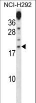 PRR15 Antibody - PRR15 Antibody western blot of NCI-H292 cell line lysates (35 ug/lane). The PRR15 antibody detected the PRR15 protein (arrow).