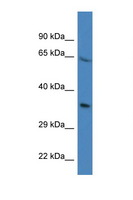PRR16 Antibody - PRR16 antibody Western blot of Mouse Kidney lysate. Antibody concentration 1 ug/ml. This image was taken for the unconjugated form of this product. Other forms have not been tested.