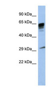 PRR18 Antibody - PRR18 antibody Western blot of Placenta lysate. This image was taken for the unconjugated form of this product. Other forms have not been tested.