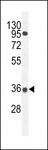 PRR19 Antibody - PRR19 Antibody western blot of A549 cell line lysates (35 ug/lane). The PRR19 antibody detected the PRR19 protein (arrow).