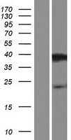 PRR20D Protein - Western validation with an anti-DDK antibody * L: Control HEK293 lysate R: Over-expression lysate