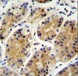 PRR22 Antibody - MGC24975 Antibody immunohistochemistry of formalin-fixed and paraffin-embedded human stomach tissue followed by peroxidase-conjugated secondary antibody and DAB staining.