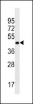 PRR25 Antibody - PRR25 Antibody western blot of Uterus tissue lysates (35 ug/lane). The PRR25 antibody detected the PRR25 protein (arrow).