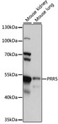 PRR5 Antibody - Western blot analysis of extracts of various cell lines, using PRR5 antibody at 1:1000 dilution. The secondary antibody used was an HRP Goat Anti-Rabbit IgG (H+L) at 1:10000 dilution. Lysates were loaded 25ug per lane and 3% nonfat dry milk in TBST was used for blocking. An ECL Kit was used for detection and the exposure time was 10s.