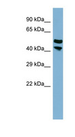 PRR5L / FLJ14213 Antibody - PRR5L / FLJ14213 antibody Western blot of THP-1 cell lysate. This image was taken for the unconjugated form of this product. Other forms have not been tested.