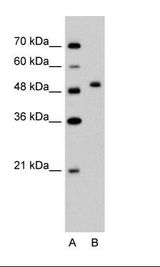 PRR5L / FLJ14213 Antibody - A: Marker, B: Jurkat Cell Lysate.  This image was taken for the unconjugated form of this product. Other forms have not been tested.