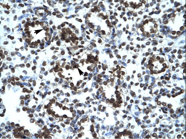 PRR7 Antibody - PRR7 antibody ARP34723_P050-NP_085044-PRR7 (proline rich 7 (synaptic)) Antibody was used in IHC to stain formalin-fixed, paraffin-embedded human lung.  This image was taken for the unconjugated form of this product. Other forms have not been tested.