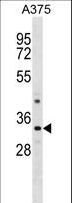 PRR7 Antibody - PRR7 Antibody western blot of A375 cell line lysates (35 ug/lane). The PRR7 antibody detected the PRR7 protein (arrow).