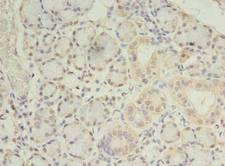 PRRC1 Antibody - Immunohistochemistry of paraffin-embedded human pancreatic tissue using antibody at dilution of 1:100.