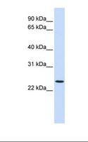PRRG3 / TMG3 Antibody - Jurkat cell lysate. Antibody concentration: 1.0 ug/ml. Gel concentration: 12%.  This image was taken for the unconjugated form of this product. Other forms have not been tested.