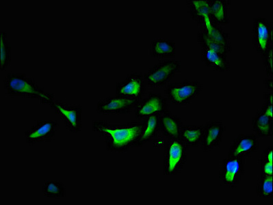PRRG3 / TMG3 Antibody - Immunofluorescent analysis of Hela cells using PRRG3 Antibody at dilution of 1:100 and Alexa Fluor 488-congugated AffiniPure Goat Anti-Rabbit IgG(H+L)