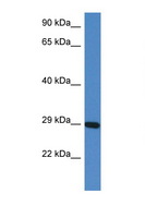 PRRG3 / TMG3 Antibody - PRRG3 antibody Western blot of Mouse Heart lysate. Antibody concentration 1 ug/ml.  This image was taken for the unconjugated form of this product. Other forms have not been tested.