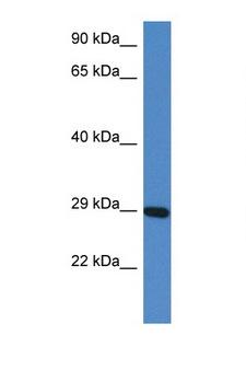 PRRG3 / TMG3 Antibody - PRRG3 antibody Western blot of Mouse Heart lysate. Antibody concentration 1 ug/ml.  This image was taken for the unconjugated form of this product. Other forms have not been tested.