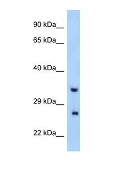 PRRG4 Antibody - PRRG4 antibody Western blot of Mouse Liver lysate. Antibody concentration 1 ug/ml.  This image was taken for the unconjugated form of this product. Other forms have not been tested.