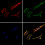 PRRT1 Antibody - Staining HeLa cells by IF/ICC. The samples were fixed with PFA and permeabilized in 0.1% Triton X-100, then blocked in 10% serum for 45 min at 25°C. Samples were then incubated with primary Ab(1:200) and mouse anti-beta tubulin Ab(1:200) for 1 hour at 37°C. An AlexaFluor594 conjugated goat anti-rabbit IgG(H+L) Ab(1:200 Red) and an AlexaFluor488 conjugated goat anti-mouse IgG(H+L) Ab(1:600 Green) were used as the secondary antibod
